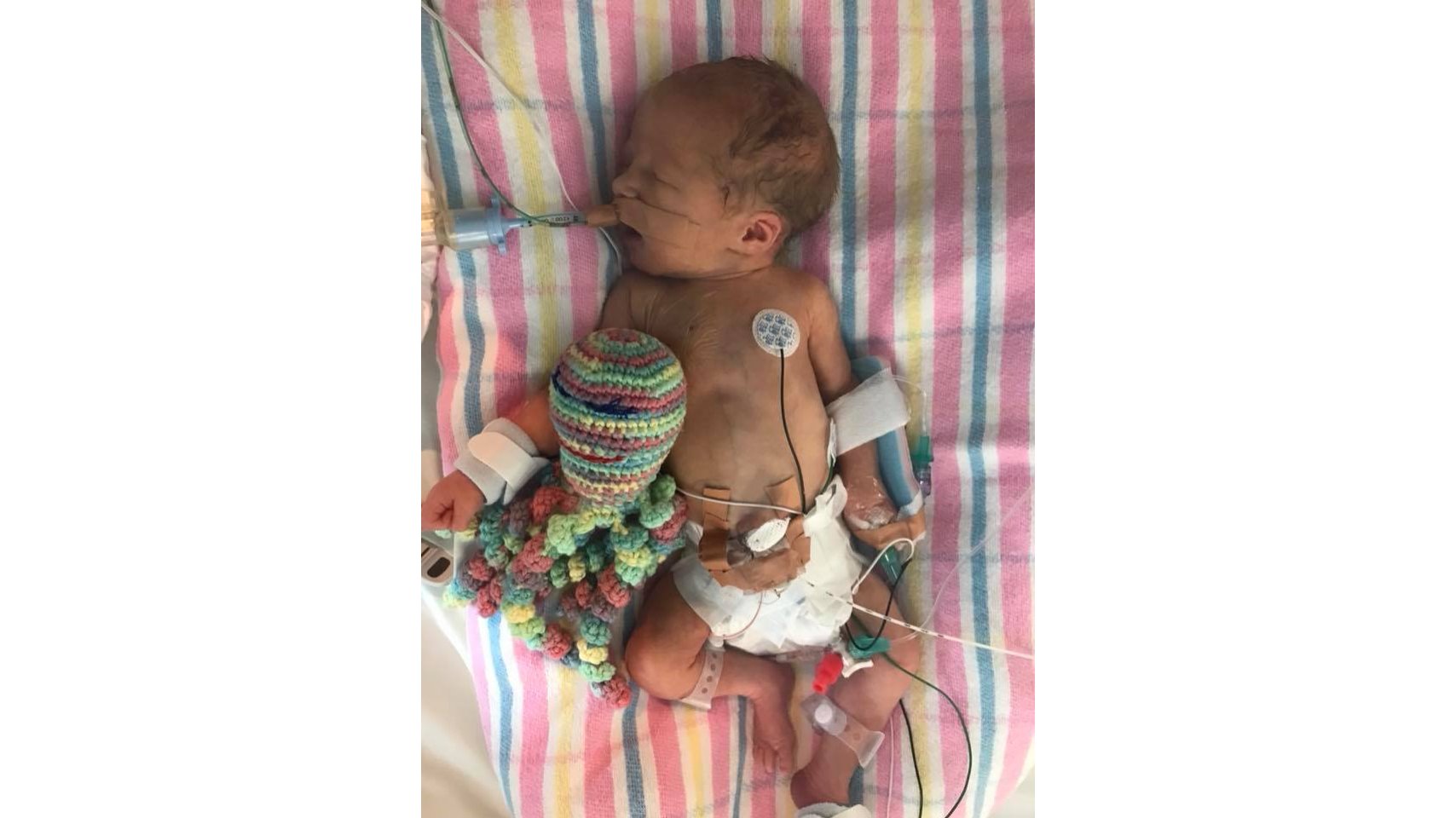 Willow Faith's NICU Journey