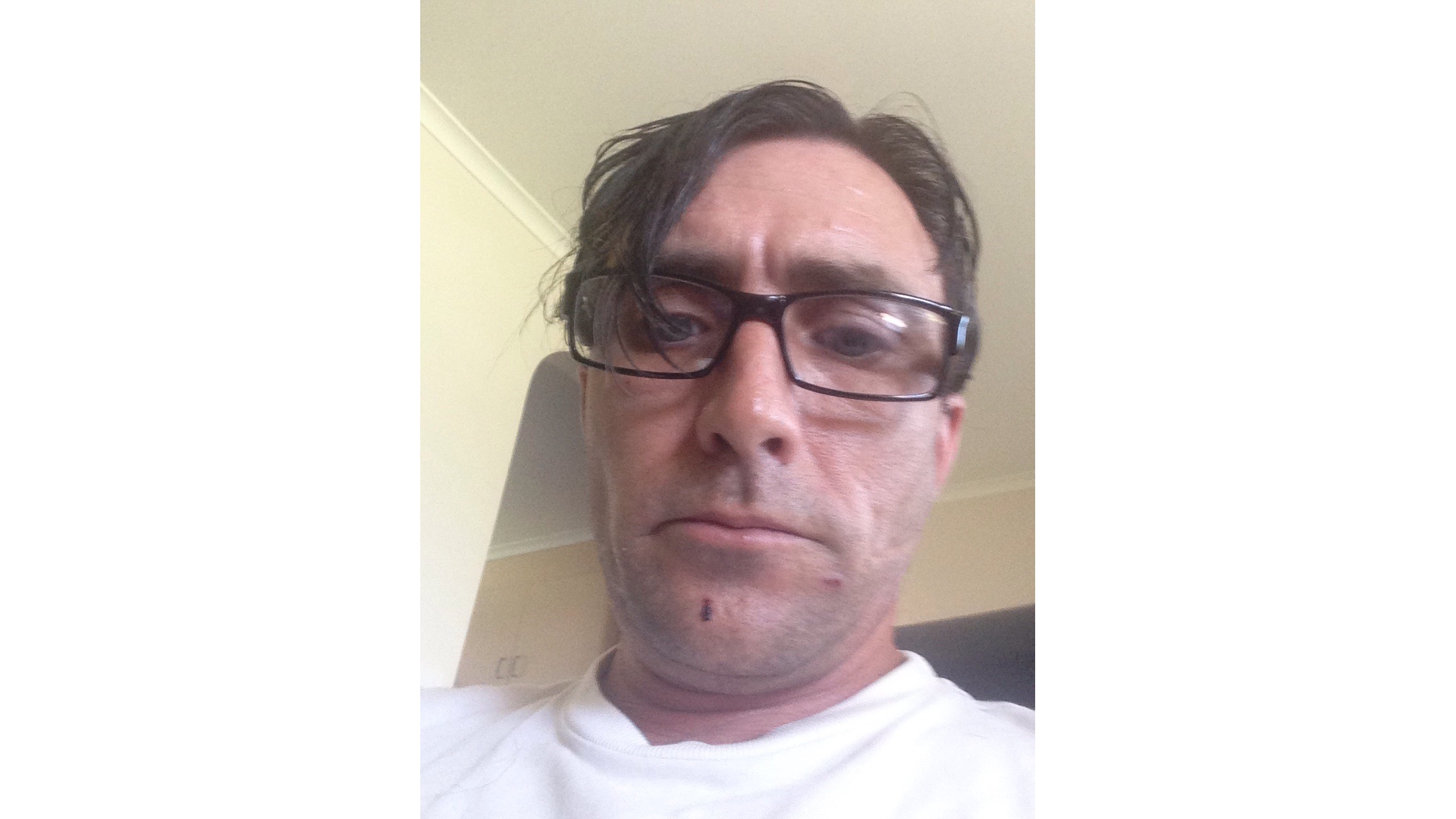 Burgers disease fund