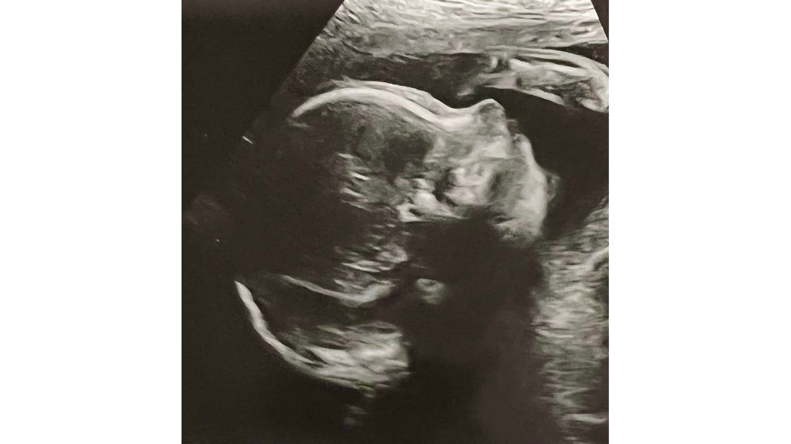 Baby needs a start for his broken heart